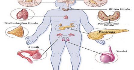 ZA SVAKU BOLJKU: URADITE UNUTRAŠNJU OPERACIJU ORGANIZMA I TO BEZ NOŽA!