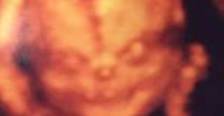 Ovi roditelji su otišli da vide svoju bebu na ultrazvuku i prestravili su se!
