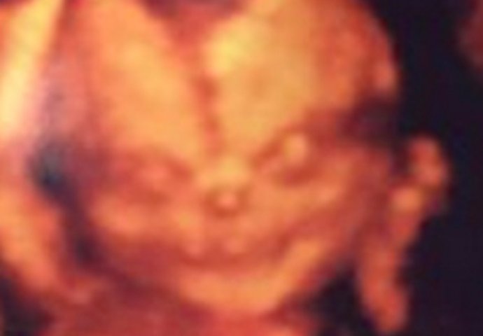 Ovi roditelji su otišli da vide svoju bebu na ultrazvuku i prestravili su se!