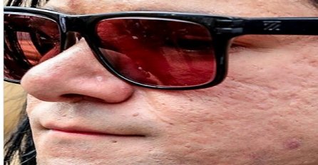 Svi znamo da i poznate zvijezde imaju mane! Ove slike su dokaz da ni oni nisu savršeni kao što se predstavljaju! (FOTO)