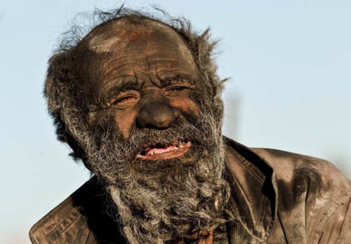 Ovaj čovjek se nije kupao 60 godina! Nećete vjerovati kako mu koža izgleda (FOTO)