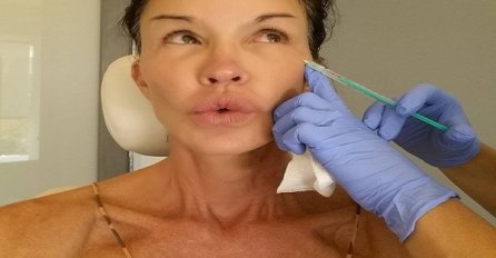 Kakav selfi: Ne odustaje od botoksa iako zna da pretjeruje!