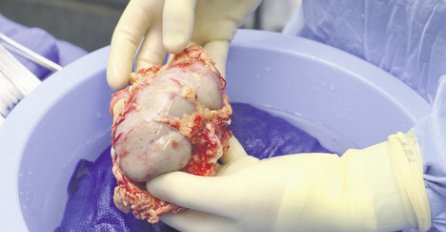 SLOVENIJA- Čovjek koji je objavio oglas da prodaje bubreg da bi preživio je prevarant!