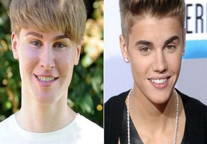 Muškarac koji je potrošio 100.000 dolara na plastične operacije da izgleda kao Justin Bieber, pronađen je mrtav!