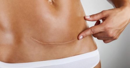 Šta vi mislite? Ova fotografija  uzdrmala je svijet i izazvala brojne polemike 