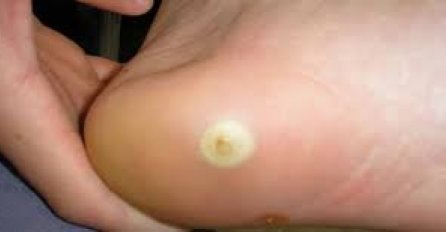 Ukoliko imate problema s kurjim okom, ova voćka će ga riješiti