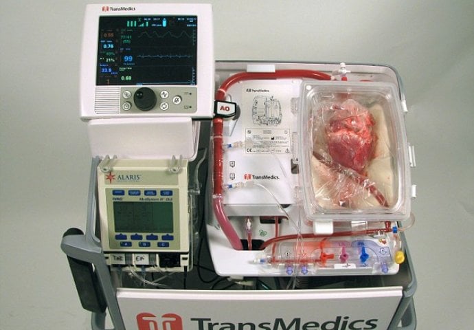 Fascinantno: Pogledajte kako srce živi van tijela dok čeka na transplantaciju!