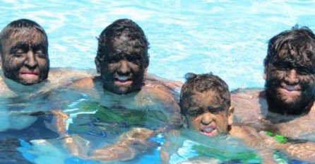 (VIDEO) Oni su najdlakavija porodica na svijetu, zbog toga su predmet ismijavanja mnogih!