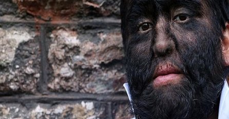 “Moj cirkuski život je počeo kada sam imao 13 godina” (VIDEO)