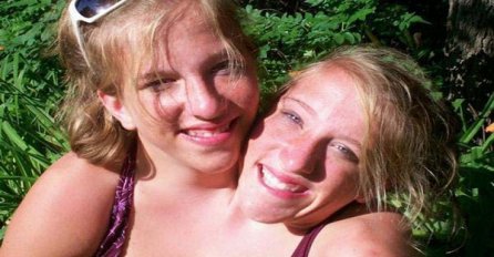 One dijele jedno tijelo,ali savršeno funkcionišu (VIDEO)