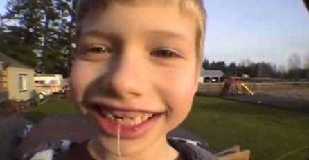 Dječak izvadio zub raketom : Ludorija koja je totalno van pameti (VIDEO)