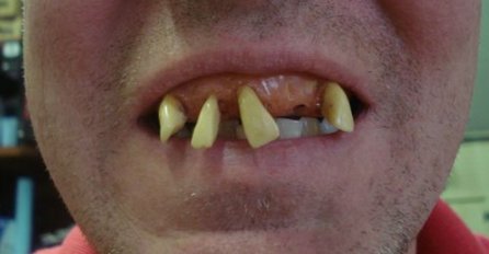 11 NAJGLUPLJIH IZUMA koji su zaradili milione: Od čuvenih kroksica do kamenog ljubimca! 