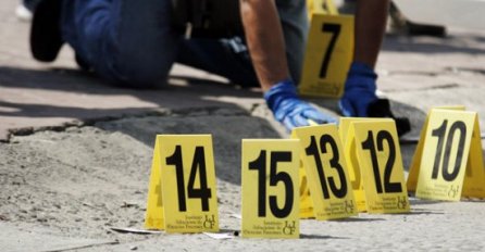 Ubio plastičnog hirurga jer mu se nos i dalje činio glomaznim