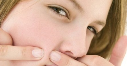 Evo kako se riješiti dosadnih prištića od znoja