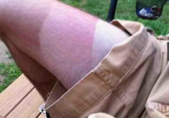 Zbog ovih izvala poželim da ljeto duže potraje (FOTO)