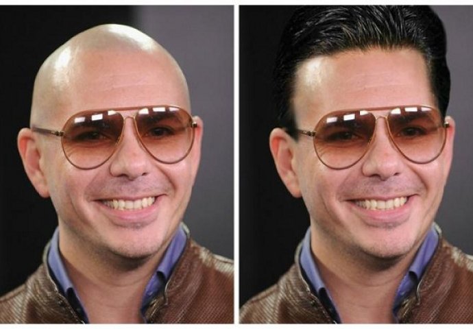 Kako bi ćelave hollywoodske  zvijezde izgledale sa kosom?