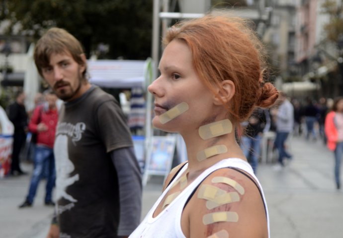 Djevojka prekrivena ranama i modricama je stajala na Trgu, od reakcije prolaznika ćete zanijemiti