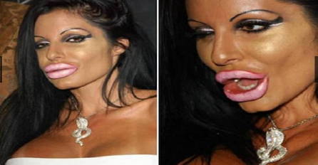 Živi dokaz da se plastične operacije mogu otrgnut kontroli! (FOTO)