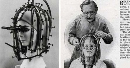 5 bizarnih naprava koje su nekada služile za uljepšavanje