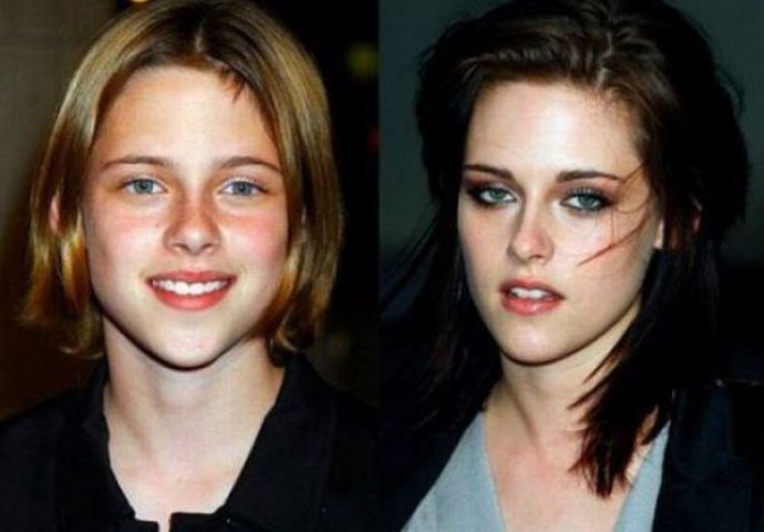 Ove svoje fotografije bi svjetske poznate ličnosti najradije spalili - da mogu (FOTO) 