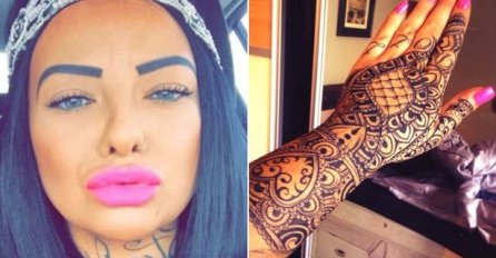 Otpuštena pola sata nakon što je dobila posao - čim su vidjeli njenu ruku