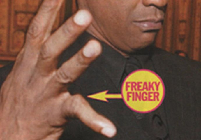 Ove slavne zvijezde imaju bizarne mane na tijelima: Broj 3 na listi će vas itekako zaprepastiti