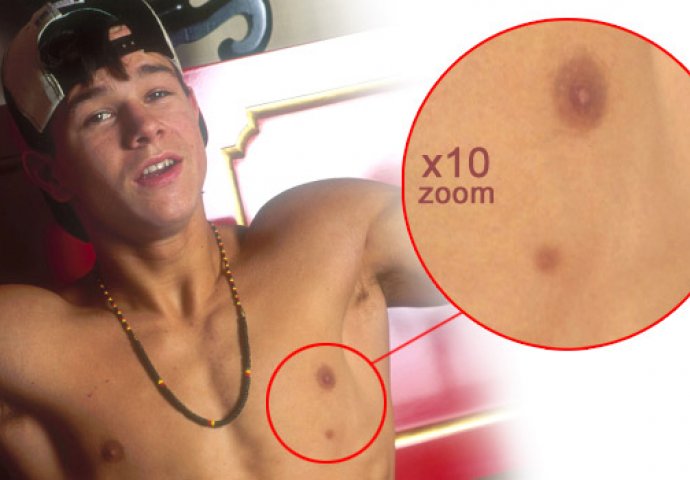 Ove slavne zvijezde imaju bizarne mane na tijelima: Broj 3 na listi će vas itekako zaprepastiti