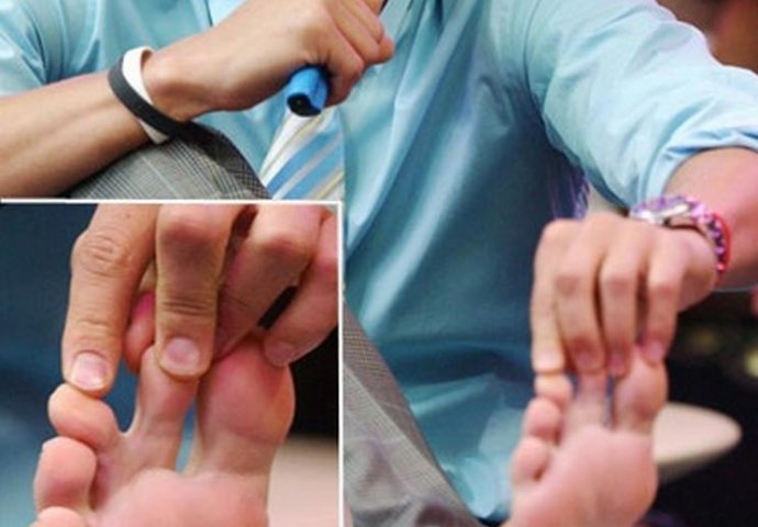 Ove slavne zvijezde imaju bizarne mane na tijelima: Broj 3 na listi će vas itekako zaprepastiti