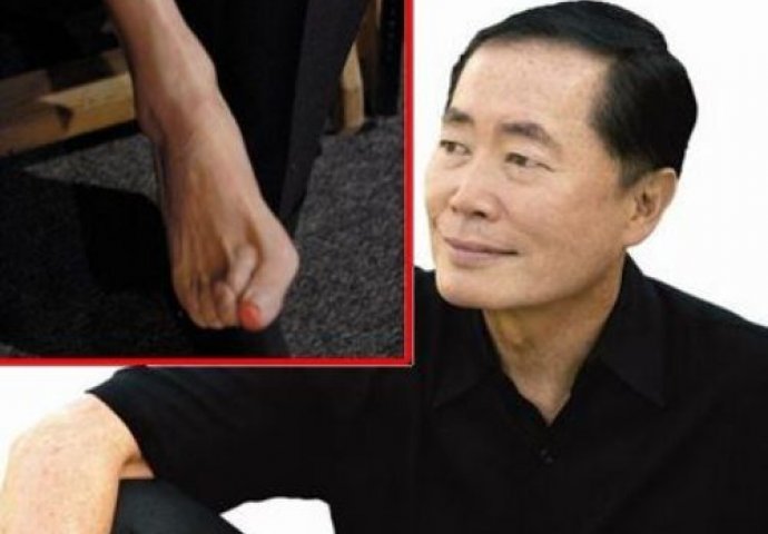 Ove slavne zvijezde imaju bizarne mane na tijelima: Broj 3 na listi će vas itekako zaprepastiti