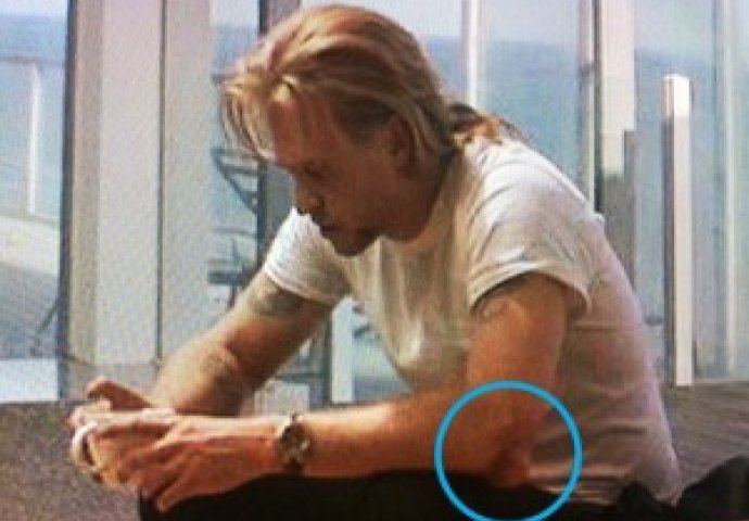 Ove slavne zvijezde imaju bizarne mane na tijelima: Broj 3 na listi će vas itekako zaprepastiti