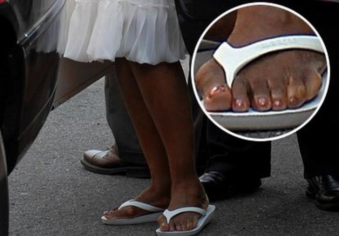 Ove slavne zvijezde imaju bizarne mane na tijelima: Broj 3 na listi će vas itekako zaprepastiti