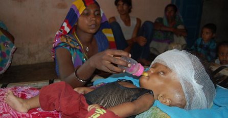 Djevojčica s natečenom glavom dobit će priliku za normalan život