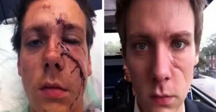 On je dokazao da je ljudsko tijelo čudo prirode (VIDEO)