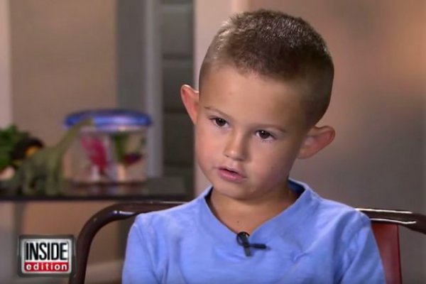 parents-allow-bullied-6-year-old-boy-with-to-get-plastic-surgery-660x440