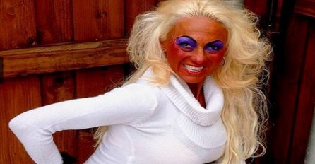 Kada solarijum ''prepeče'' povratka više nema!