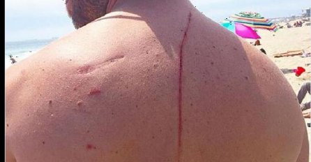 Napala ga je ajkula, ali nije ni mogao slutiti da će mu baš ona spasiti život! 