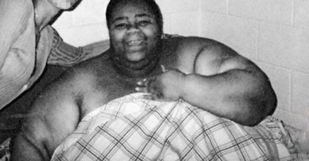  Težila je skoro pola tone, a onda je smršala i obukla bikini