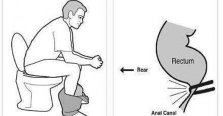Znate li da samo rijetki nuždu vrše na pravilan način, budite jedan od njih (FOTO)