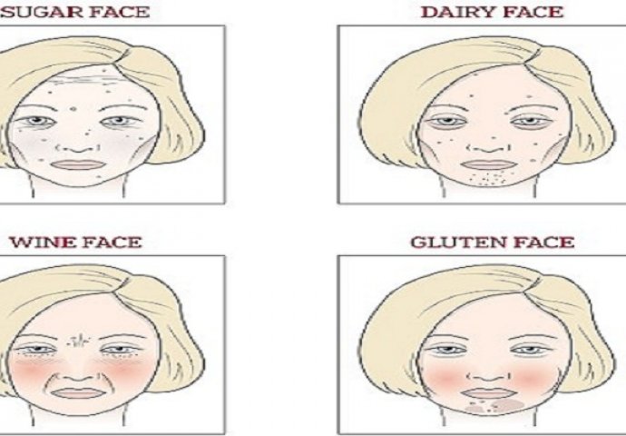 Koje od njih je vaše lice - šteti li vam šećer, vino ili gluten?