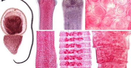 Zabilježen prvi poznati slučaj parazitske "zaraze rakom"