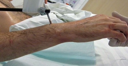 "Dva mjeseca poslije mog odlaska on je imao moždani udar, doktori su ga otpisali"