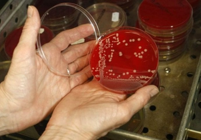  Ljudi će umirati zbog bakterije otporne na najjače antibiotike