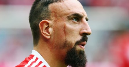 Ribery se u Zagrebu ponovno povrijedio