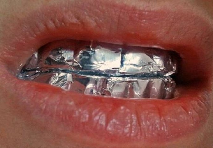 Stavite aluminijsku foliju na zube i držite sat vremena, evo šta će vam se desiti