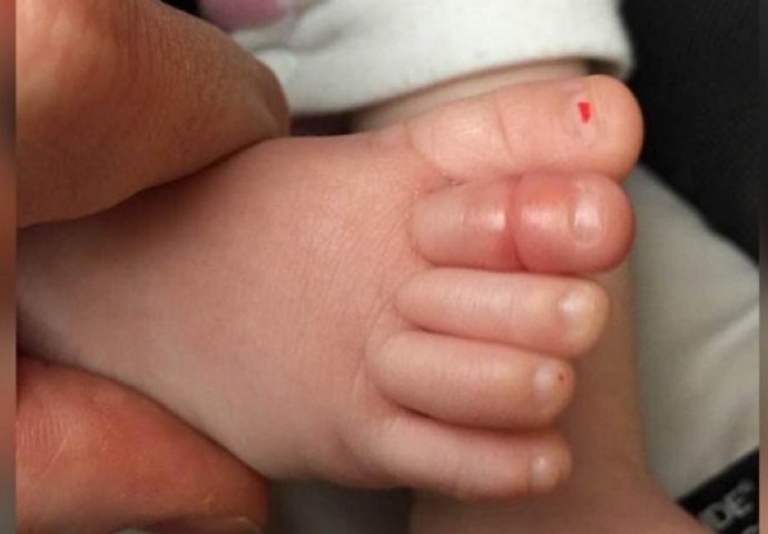 Beba je plakala bez prestanka: Roditelji su onda otkrili ovo na njenom nožnom prstu (VIDEO) 