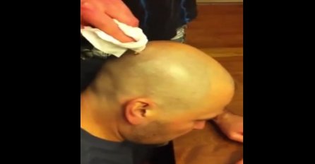 Nije za osobe sa slabim želucem: Pogledajte kakav su mu užas izvadili iz glave (VIDEO)