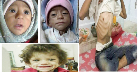 Grad gdje djeca umiru od gladi, gdje je paketić riže bogatstvo i gdje jedu mačke da bi preživjeli (FOTO)