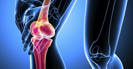 Osteoartritis: Uzrok, simptomi i liječenje