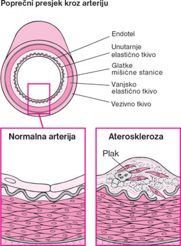 arterija