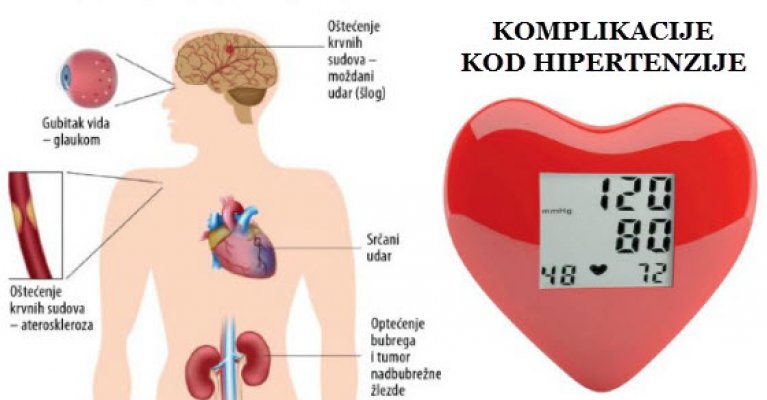 hipertenzija liječenje srca)